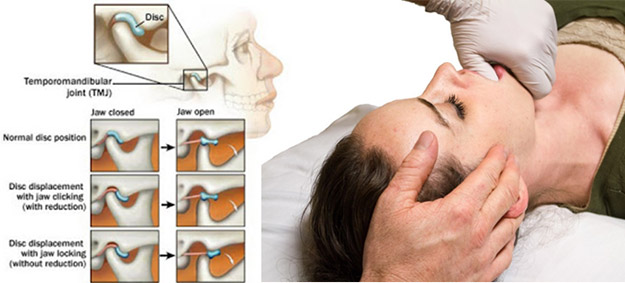 Oral facial pain treatment center wisconsin