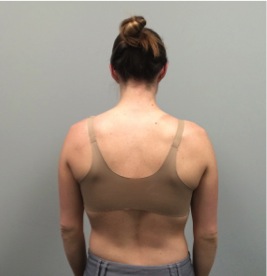 Poor Shoulder posture